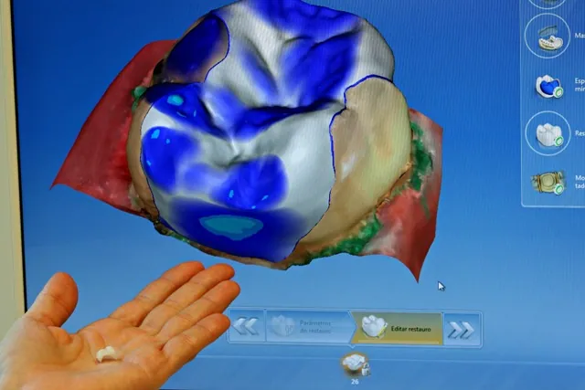 Tecnologia 3D chega aos consultórios odontológicos