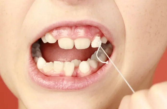 Campanha pede que crianças doem dentes de leite em prol da ciência
